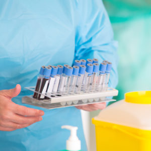 La provincia de Toledo suma un nuevo caso de viruela del mono