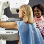 mamografia cancer mama