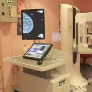 Talavera completa su programa de mamografías seis meses después de sufrir un parón